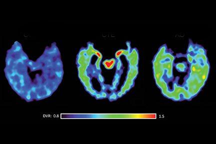 Three brain scans